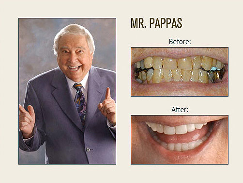 Pappas Before and After